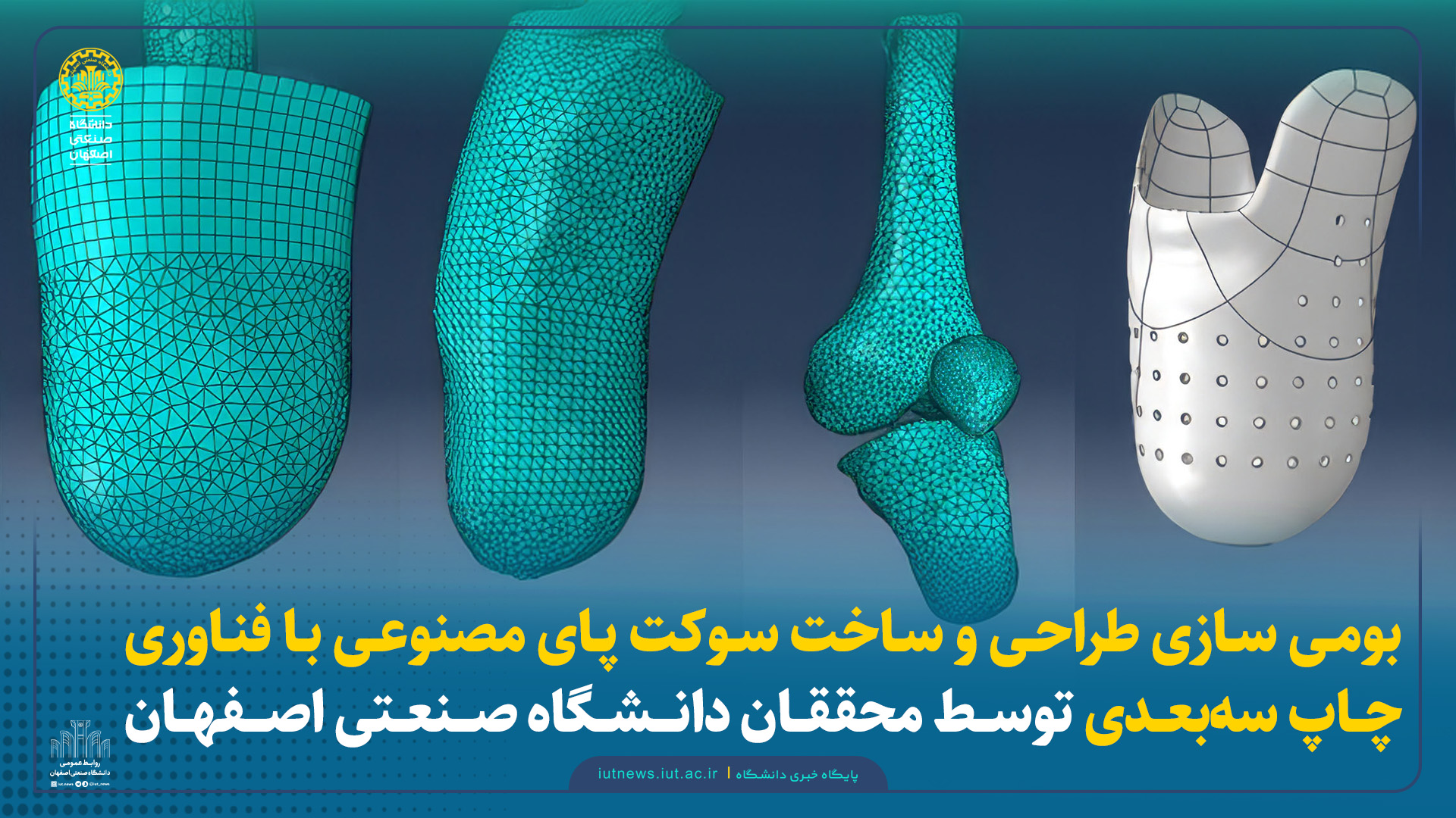بومی سازی طراحی و ساخت سوکت پای مصنوعی با فناوری چاپ سه‌بعدی توسط محققان دانشگاه صنعتی اصفهان